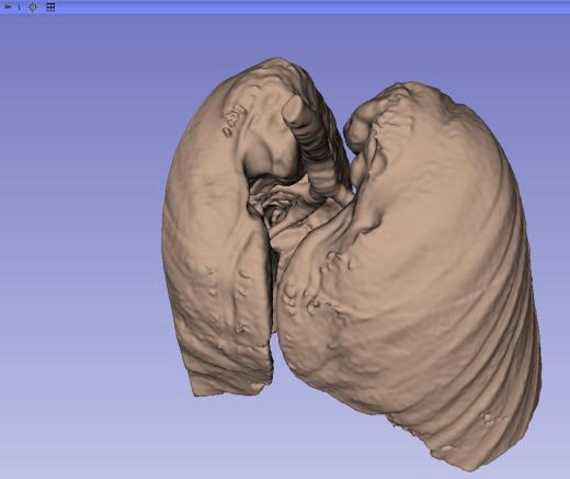 人类肺部的3D模型缩略图