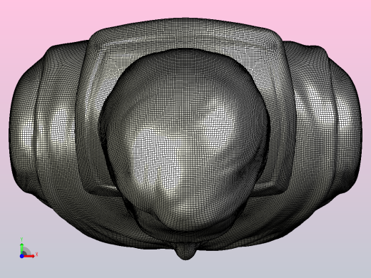 世纪金特勒曼前视缩略图