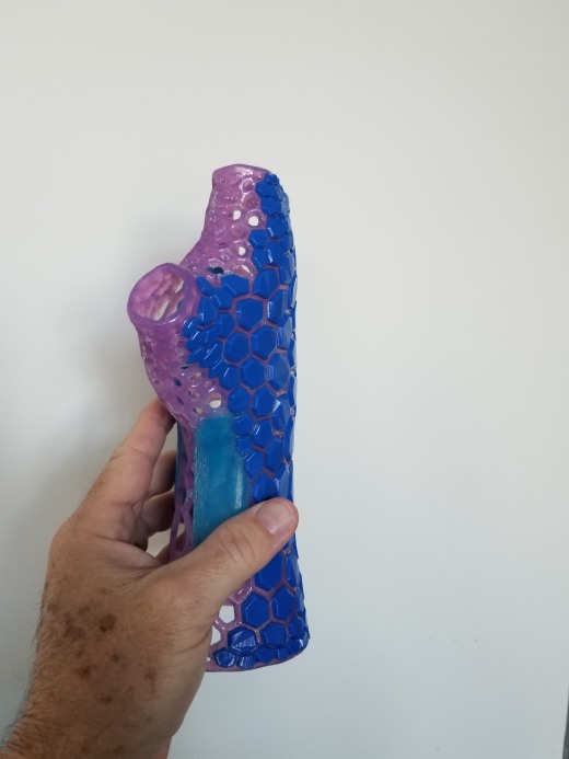 这是一个定制的适合和打印的三维扫描制成的手腕支撑。主手套-袖子是柔性的，集成有刚性支撑部分缩略图