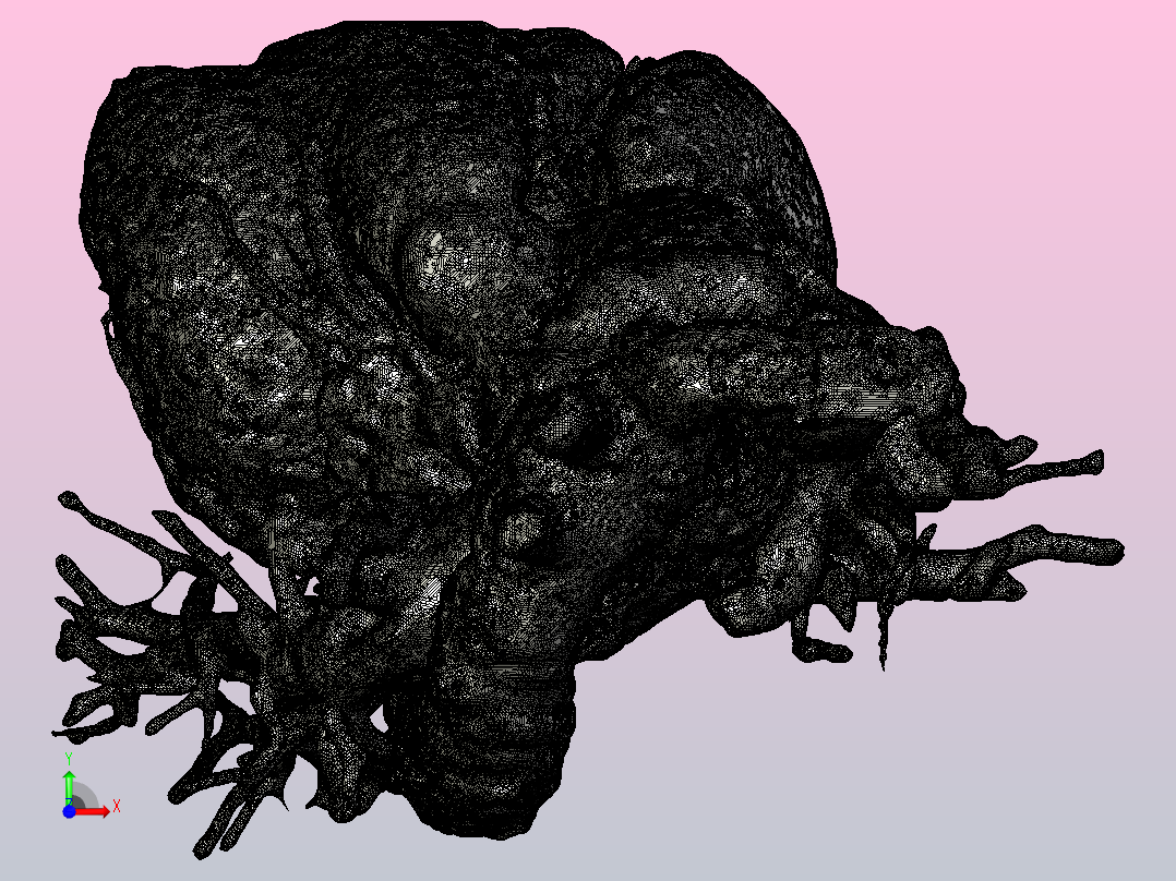 人心脏的3D模型前视图