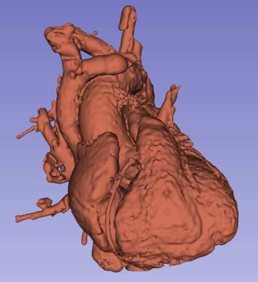 人心脏的3D模型缩略图