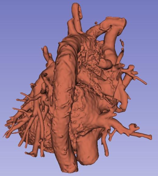 人心脏的3D模型缩略图