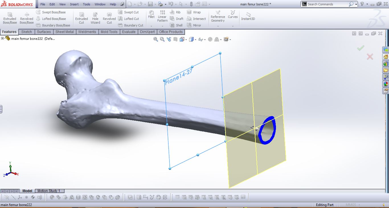 股骨远端是腿部膝关节正上方的区域