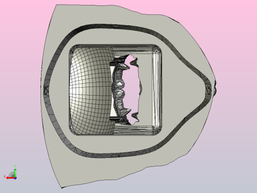 “星球大战脸”(SARS)面具后视缩略图