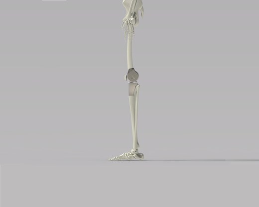 膝关节肿瘤假体缩略图