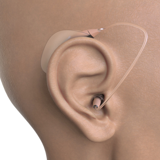 柔性助听器缩略图