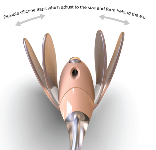 柔性助听器缩略图